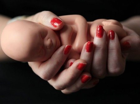 Azərbaycanda qadınların dəhşətli abort statistikası – Aralarında 15 yaşlı qızlar da var…