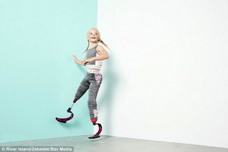 İki ayağı kəsilmiş 7 yaşlı qız model oldu - Fotoları