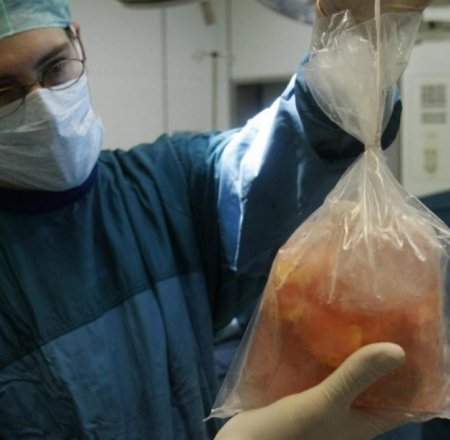 Ermənistan hökumətinin iclasında  “orqan mafiyası”nın fəallaşması müzakirə olunub