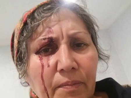 Qaçırılan qızın qohumları oğlanın evinə hücum etdilər, ərlə arvadı bıçaqladılar - FOTO
