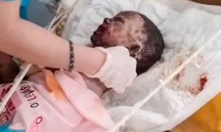 2 yaşlı Anjelanı anası yandırıb? - Xala DƏHŞƏTLİ FAKTI açıqladı