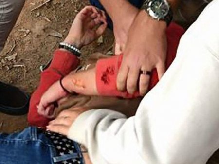 Bəbir qəfəsə dırmaşıb selfi çəkmək istəyən qadını dişlədi