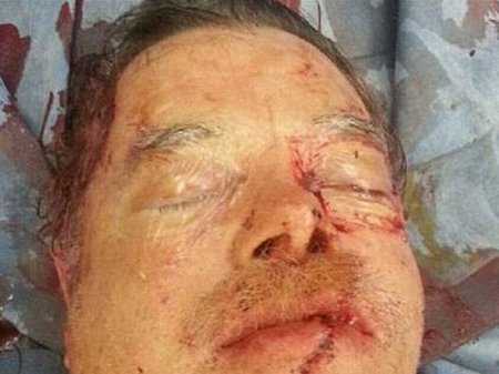 Üzünü mişarla doğradı, sonra həkim yanına yollandı - FOTO