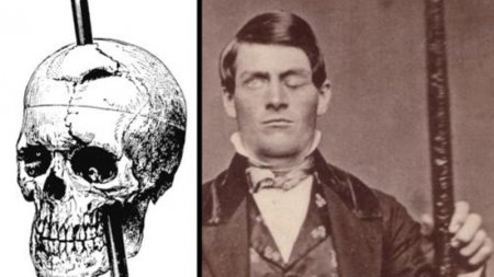 O dünyadan qayıdan 9 adam