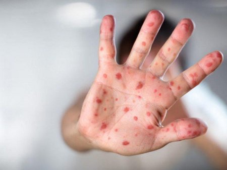 Nyu Yorkda fövqəladə vəziyyətə elan olunub