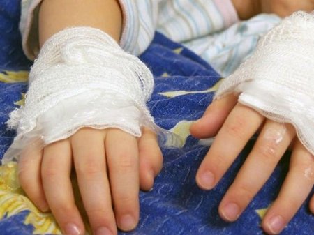 Hərbçilərimiz azyaşlını yanğından xilas etdilər