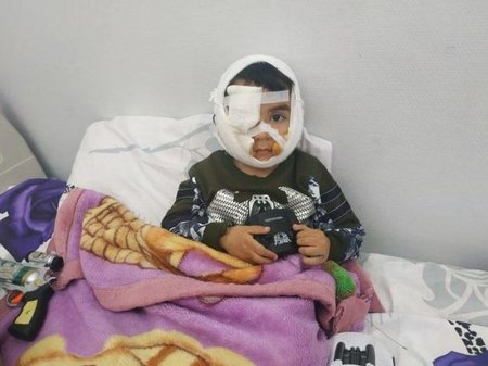 Üzünü it parçalayan Hüseyn evə buraxıldı